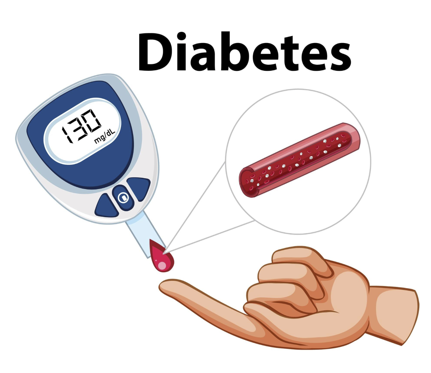 تحاليل مهمة لمتابعة السكري